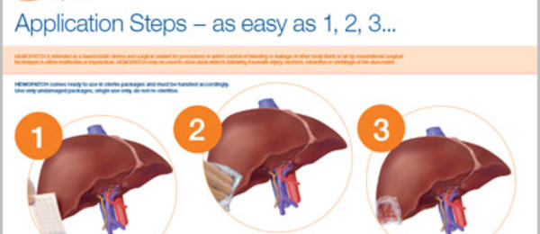 Hemopatch-Liver-Application-Guide