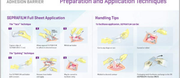 Seprafilm-Quick-Reference-Guide-for-Preparation-and-Application-UKI